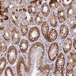 APOLD1 Antibody in Immunohistochemistry (Paraffin) (IHC (P))