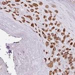 APOLD1 Antibody in Immunohistochemistry (IHC)