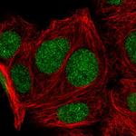 KLF16 Antibody in Immunocytochemistry (ICC/IF)