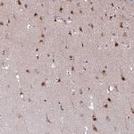 KLF16 Antibody in Immunohistochemistry (Paraffin) (IHC (P))