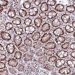 KLF16 Antibody in Immunohistochemistry (Paraffin) (IHC (P))