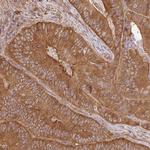 GSPT1 Antibody in Immunohistochemistry (IHC)