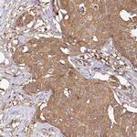 GSPT1 Antibody in Immunohistochemistry (IHC)