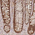 GSPT1 Antibody in Immunohistochemistry (IHC)