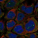 OGDHL Antibody in Immunocytochemistry (ICC/IF)