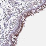 OR2D3 Antibody in Immunohistochemistry (Paraffin) (IHC (P))