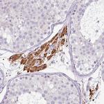 FGF17 Antibody in Immunohistochemistry (Paraffin) (IHC (P))