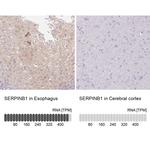 SERPINB1 Antibody in Immunohistochemistry (IHC)