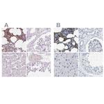 SERPINB1 Antibody in Immunohistochemistry (IHC)