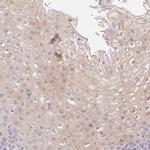 SERPINB1 Antibody in Immunohistochemistry (IHC)