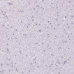 SERPINB1 Antibody in Immunohistochemistry (IHC)