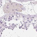 SERPINB1 Antibody in Immunohistochemistry (IHC)