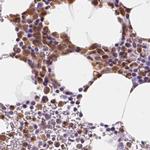 SERPINB1 Antibody in Immunohistochemistry (IHC)