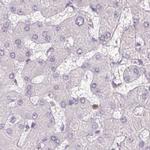 SERPINB1 Antibody in Immunohistochemistry (IHC)