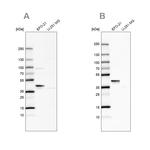 SERPINB1 Antibody in Western Blot (WB)