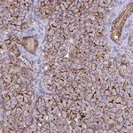 EPLIN Antibody in Immunohistochemistry (IHC)