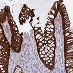 EPLIN Antibody in Immunohistochemistry (IHC)