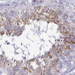 EPLIN Antibody in Immunohistochemistry (IHC)