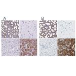 CEL Antibody in Immunohistochemistry (IHC)