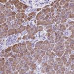 CEL Antibody in Immunohistochemistry (IHC)