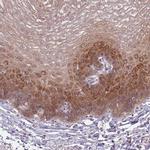 KLC3 Antibody in Immunohistochemistry (IHC)