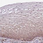 FAT4 Antibody in Immunohistochemistry (Paraffin) (IHC (P))