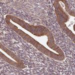 FAT4 Antibody in Immunohistochemistry (Paraffin) (IHC (P))