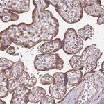 FAT4 Antibody in Immunohistochemistry (Paraffin) (IHC (P))