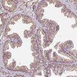 FAT4 Antibody in Immunohistochemistry (Paraffin) (IHC (P))