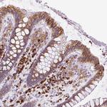 DDOST Antibody in Immunohistochemistry (Paraffin) (IHC (P))