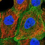 Nhe-1 Antibody in Immunocytochemistry (ICC/IF)