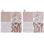 Nhe-1 Antibody in Immunohistochemistry (IHC)