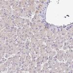 Nhe-1 Antibody in Immunohistochemistry (IHC)