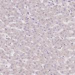 ATP8A1 Antibody in Immunohistochemistry (Paraffin) (IHC (P))