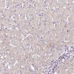 ATP8A1 Antibody in Immunohistochemistry (IHC)