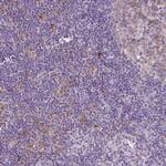 C9orf24 Antibody in Immunohistochemistry (Paraffin) (IHC (P))