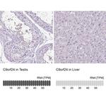 C9orf24 Antibody in Immunohistochemistry (IHC)