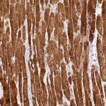 PHOSPHO1 Antibody in Immunohistochemistry (Paraffin) (IHC (P))