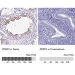 ZPBP2 Antibody in Immunohistochemistry (IHC)