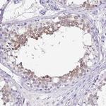 ZPBP2 Antibody in Immunohistochemistry (IHC)