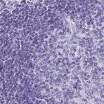 ZPBP2 Antibody in Immunohistochemistry (IHC)