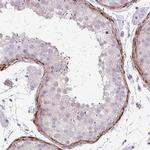 COL8A1 Antibody in Immunohistochemistry (Paraffin) (IHC (P))