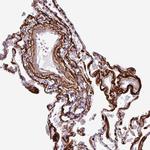 COL8A1 Antibody in Immunohistochemistry (IHC)