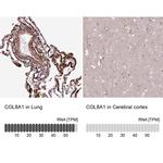 COL8A1 Antibody