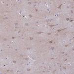 AdoHcyase 3 Antibody in Immunohistochemistry (IHC)