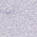 AdoHcyase 3 Antibody in Immunohistochemistry (IHC)