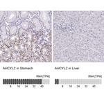 AdoHcyase 3 Antibody