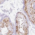 RBMY1F Antibody in Immunohistochemistry (Paraffin) (IHC (P))