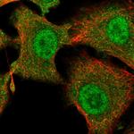 TESC Antibody in Immunocytochemistry (ICC/IF)