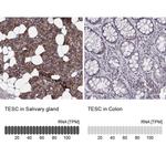 TESC Antibody in Immunohistochemistry (IHC)